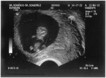 Ultrasound 12April2013b